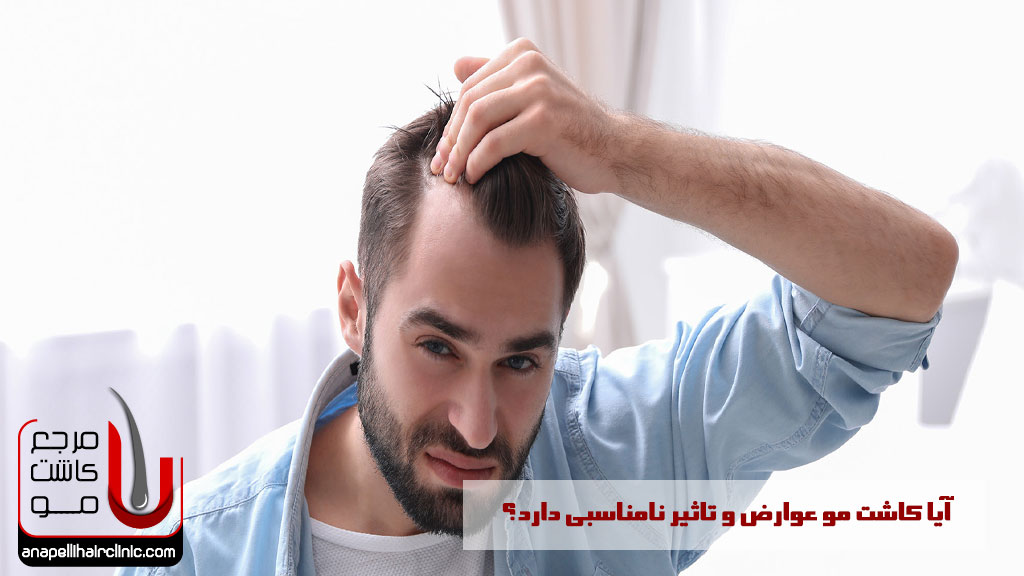 آیا کاشت مو عوارض و تاثیر نامناسبی دارد؟