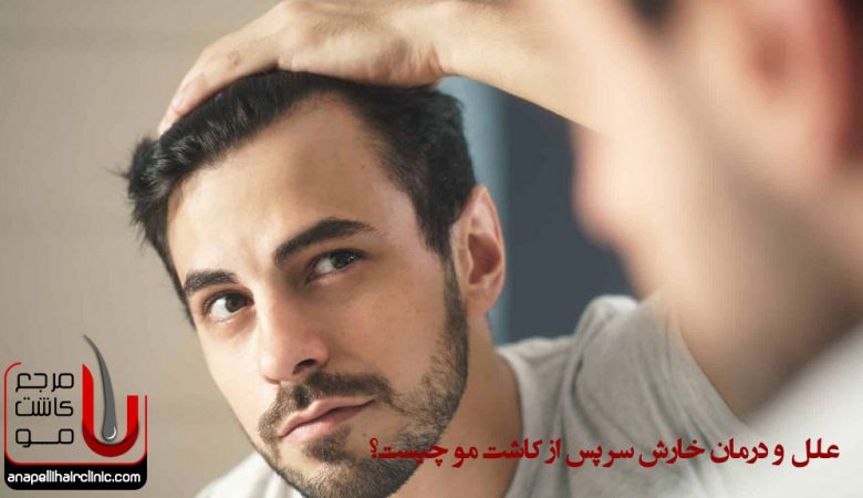 علل و درمان خارش سر پس از کاشت مو